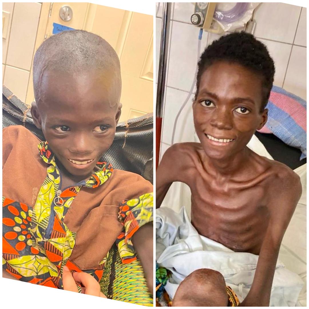 HOH Togo Pediatric Care Malnutrition Fund
